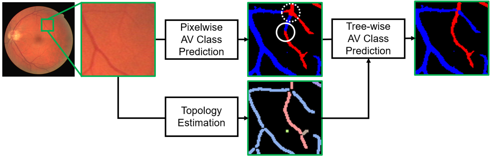 Topology-aware retinal artery–vein classification via deep vascular connectivity prediction.